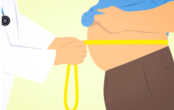 Az elhízás megbetegít - Súlyos gyulladást okoz a szervezetben